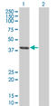 CLN3 Lysosomal/Endosomal Transmembrane Protein, Battenin antibody, LS-C196935, Lifespan Biosciences, Western Blot image 
