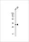 Proenkephalin-A antibody, M07495, Boster Biological Technology, Western Blot image 