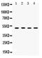 Sulfotransferase Family 2B Member 1 antibody, PA5-80085, Invitrogen Antibodies, Western Blot image 