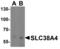 Solute Carrier Family 38 Member 4 antibody, LS-C358499, Lifespan Biosciences, Western Blot image 