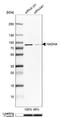 Hydroxyacyl-CoA Dehydrogenase Trifunctional Multienzyme Complex Subunit Alpha antibody, NBP1-83387, Novus Biologicals, Western Blot image 