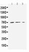 Solute Carrier Family 16 Member 1 antibody, PA2188, Boster Biological Technology, Western Blot image 