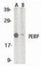 P53 Apoptosis Effector Related To PMP22 antibody, PA5-19980, Invitrogen Antibodies, Western Blot image 