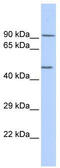 Potassium Voltage-Gated Channel Subfamily J Member 8 antibody, TA338551, Origene, Western Blot image 