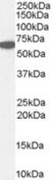 Catalase antibody, MBS421491, MyBioSource, Western Blot image 