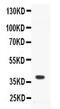 CD40 Molecule antibody, PA5-78980, Invitrogen Antibodies, Western Blot image 