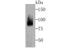 Coilin antibody, A02784, Boster Biological Technology, Western Blot image 