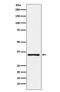 Kallikrein Related Peptidase 2 antibody, M03879-1, Boster Biological Technology, Western Blot image 