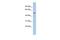 DALR Anticodon Binding Domain Containing 3 antibody, GTX45095, GeneTex, Western Blot image 