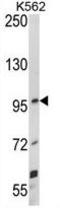 Unc-5 Netrin Receptor C antibody, GTX81651, GeneTex, Western Blot image 