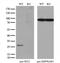 Nitrilase Family Member 2 antibody, GTX84040, GeneTex, Western Blot image 