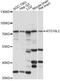Autophagy Related 16 Like 2 antibody, LS-C749929, Lifespan Biosciences, Western Blot image 