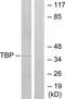 TATA-box-binding protein antibody, TA312082, Origene, Western Blot image 