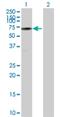 URI1 Prefoldin Like Chaperone antibody, H00008725-B01P, Novus Biologicals, Western Blot image 