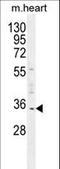 Uridine Phosphorylase 2 antibody, LS-C160449, Lifespan Biosciences, Western Blot image 