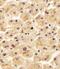 Solute Carrier Family 29 Member 2 antibody, M04718, Boster Biological Technology, Immunohistochemistry paraffin image 