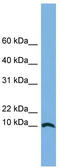 Centromere Protein X antibody, TA340377, Origene, Western Blot image 