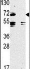 Toll Like Receptor 2 antibody, PA5-11592, Invitrogen Antibodies, Western Blot image 