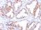 Androgen Receptor antibody, GTX34414, GeneTex, Immunohistochemistry paraffin image 