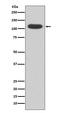 Aryl Hydrocarbon Receptor antibody, M00225, Boster Biological Technology, Western Blot image 