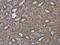 Citrin antibody, NBP1-33380, Novus Biologicals, Immunohistochemistry paraffin image 