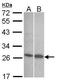 Endothelin 1 antibody, TA308770, Origene, Western Blot image 