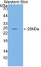 Laminin Subunit Alpha 1 antibody, LS-C314549, Lifespan Biosciences, Western Blot image 