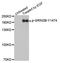 Glutamate Ionotropic Receptor NMDA Type Subunit 2B antibody, LS-C336001, Lifespan Biosciences, Western Blot image 