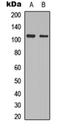 Protein Kinase D2 antibody, orb304522, Biorbyt, Western Blot image 