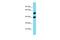 Folate Hydrolase 1B antibody, A15227, Boster Biological Technology, Western Blot image 