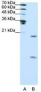 Small Nuclear Ribonucleoprotein Polypeptide F antibody, TA345828, Origene, Western Blot image 