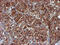 NADH:Ubiquinone Oxidoreductase Subunit B9 antibody, M08623-1, Boster Biological Technology, Immunohistochemistry paraffin image 