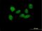 SRY-Box 6 antibody, H00055553-B01P, Novus Biologicals, Immunocytochemistry image 