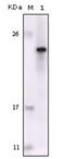 FES Proto-Oncogene, Tyrosine Kinase antibody, abx012141, Abbexa, Enzyme Linked Immunosorbent Assay image 