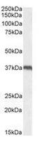 Uncoupling Protein 2 antibody, GTX89094, GeneTex, Western Blot image 