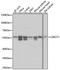 3-Oxoacid CoA-Transferase 1 antibody, GTX32770, GeneTex, Western Blot image 