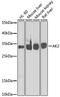 Adenylate Kinase 2 antibody, GTX55493, GeneTex, Western Blot image 