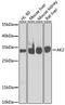 Adenylate kinase 2, mitochondrial antibody, GTX55493, GeneTex, Western Blot image 