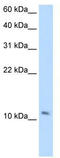 Small muscular protein antibody, TA346128, Origene, Western Blot image 