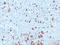 Thyroglobulin antibody, LS-C744573, Lifespan Biosciences, Immunohistochemistry paraffin image 