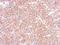 EMAP Like 1 antibody, LS-C185352, Lifespan Biosciences, Immunohistochemistry paraffin image 