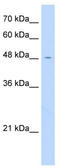 PC-Esterase Domain Containing 1A antibody, TA346639, Origene, Western Blot image 