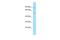 Protein Phosphatase With EF-Hand Domain 2 antibody, A14559, Boster Biological Technology, Western Blot image 