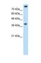 Thiosulfate Sulfurtransferase antibody, NBP1-54682, Novus Biologicals, Western Blot image 