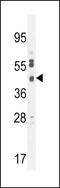 Solute Carrier Family 35 Member F6 antibody, LS-C168344, Lifespan Biosciences, Western Blot image 