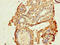 Cyclin Dependent Kinase 7 antibody, LS-C677474, Lifespan Biosciences, Immunohistochemistry paraffin image 