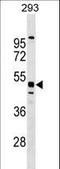 Testis Expressed Metallothionein Like Protein antibody, LS-C158327, Lifespan Biosciences, Western Blot image 