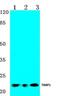 TIMP Metallopeptidase Inhibitor 1 antibody, GTX66643, GeneTex, Western Blot image 