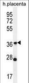 Olfactory Receptor Family 4 Subfamily L Member 1 antibody, LS-C163203, Lifespan Biosciences, Western Blot image 