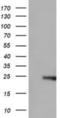 Rho GDP Dissociation Inhibitor Alpha antibody, NBP2-02467, Novus Biologicals, Western Blot image 